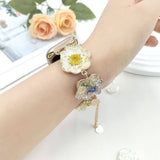 IWATCH8 1 TRANSPARENT DAISY DRIED FLOWER STRAP_CWWW0058